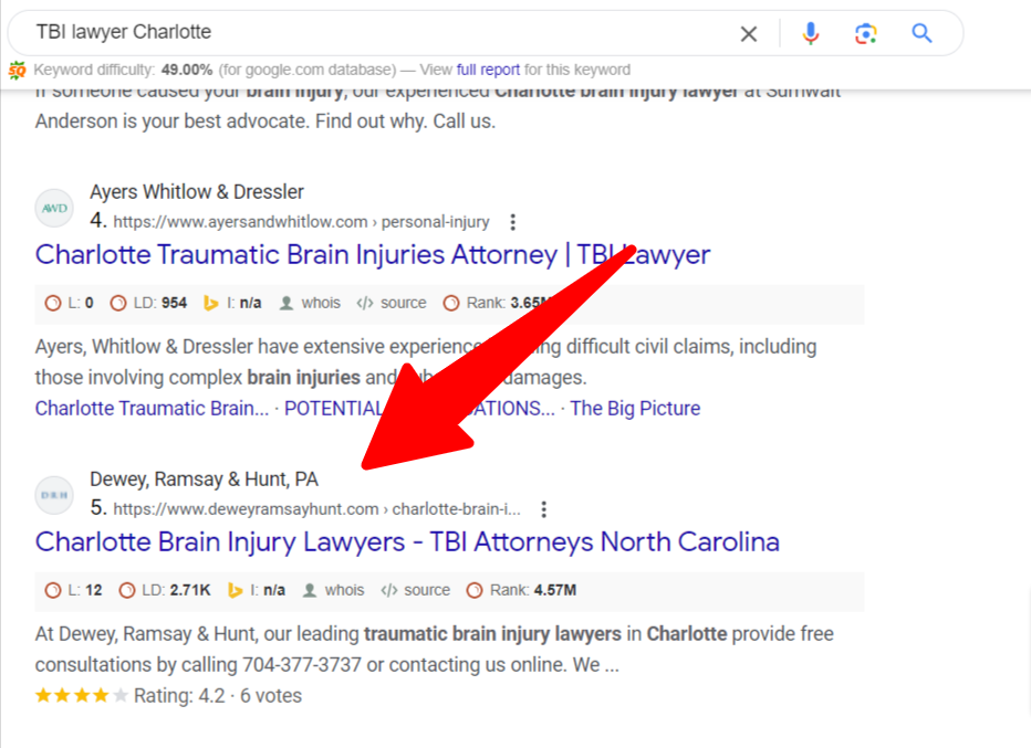 TBI Lawyer Charlotte